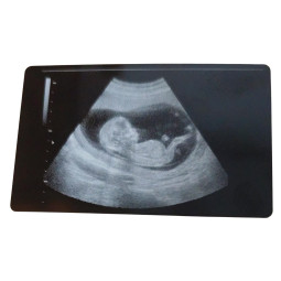 Foto eco personalizada